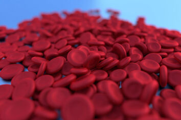 Anemia falciforme: come migliorare la diagnosi nei Paesi meno sviluppati?