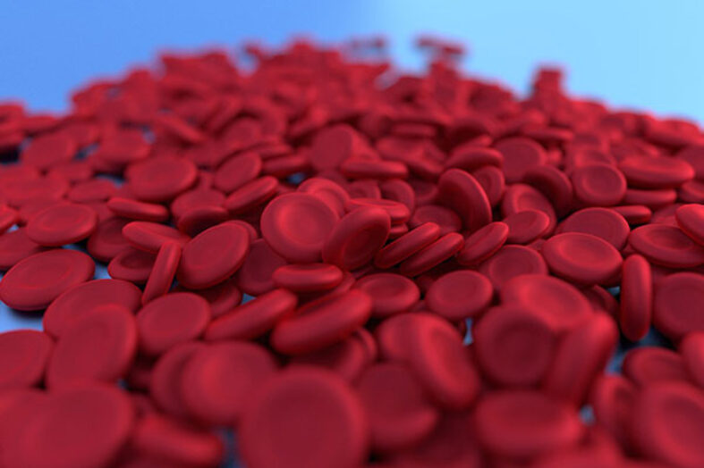 Anemia falciforme: come migliorare la diagnosi nei Paesi meno sviluppati?