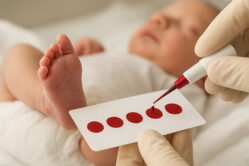 SIMMESN, dieci anni dalla legge sullo screening neonatale esteso: diagnosi precoce, equità e presa in carico